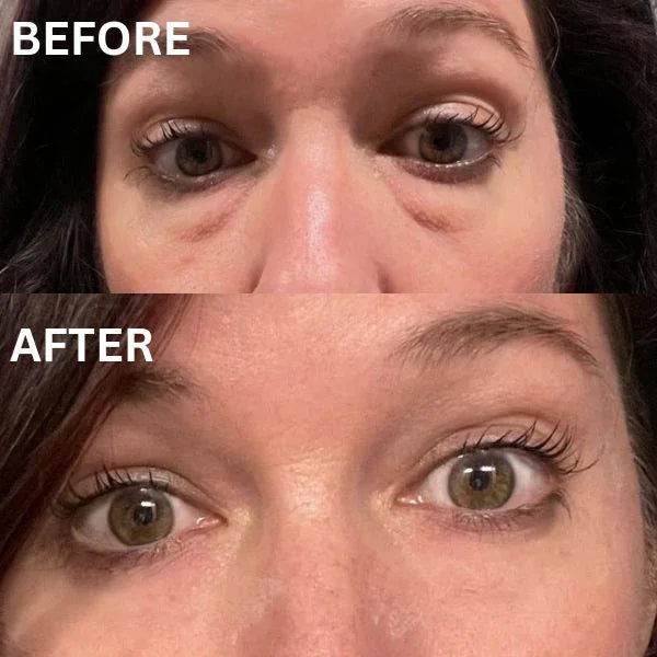 GlowHaven Instant Firm Patches