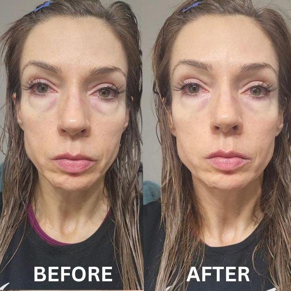 GlowHaven Instant Firm Patches