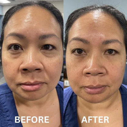 GlowHaven Instant Firm Patches