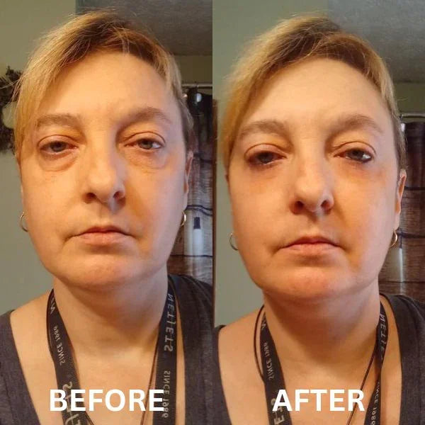 GlowHaven Instant Firm Patches