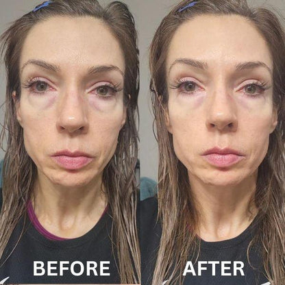 GlowHaven Instant Firm Patches